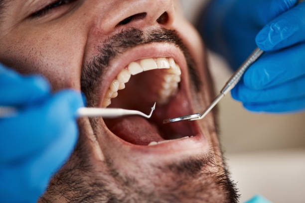 Best Broken or Cracked Tooth Emergency Dentist in Cetronia, PA